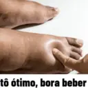 Límmiði
