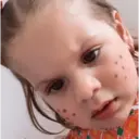 ملصق