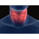 สติกเกอร์